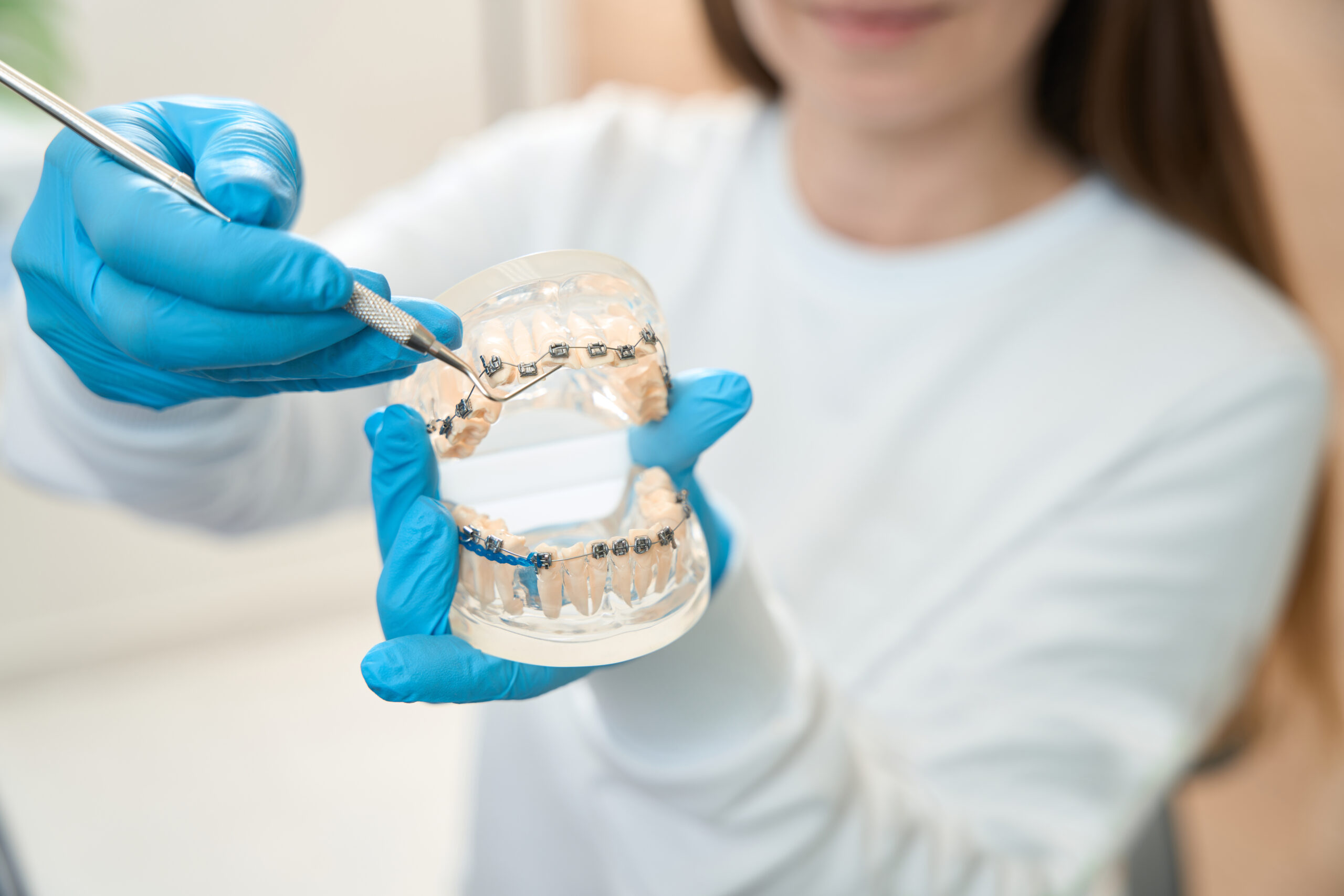The Benefits of Invisalign for Adults and Teens in McKinney, TX