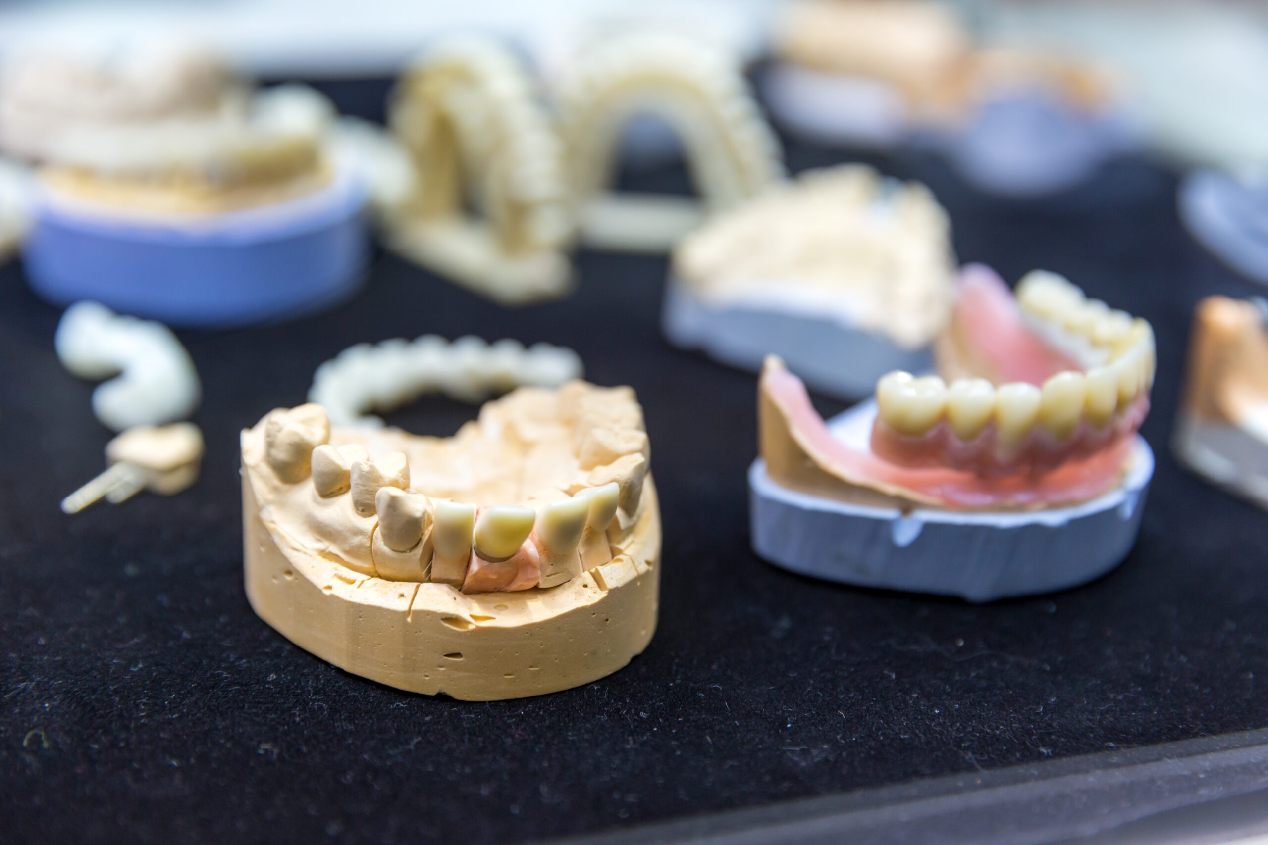 Dental Implants vs. Dentures: Which Is Right for You?