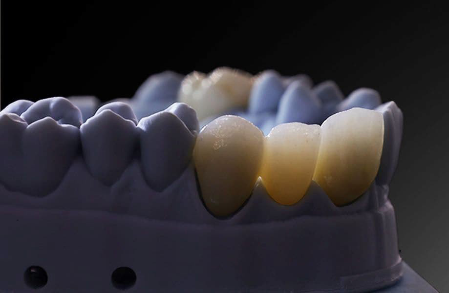 Bioceramic Materials in Dentistry and Their Transformative Impact