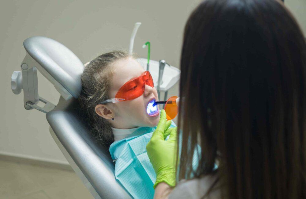 Does My Child Need Dental Sealants? A Smart Step Toward Cavity-Free Smiles