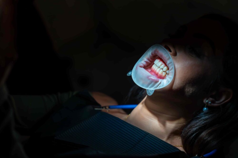 Understanding Gum Recession: Causes, Treatment Advances, and How to Protect Your Smile