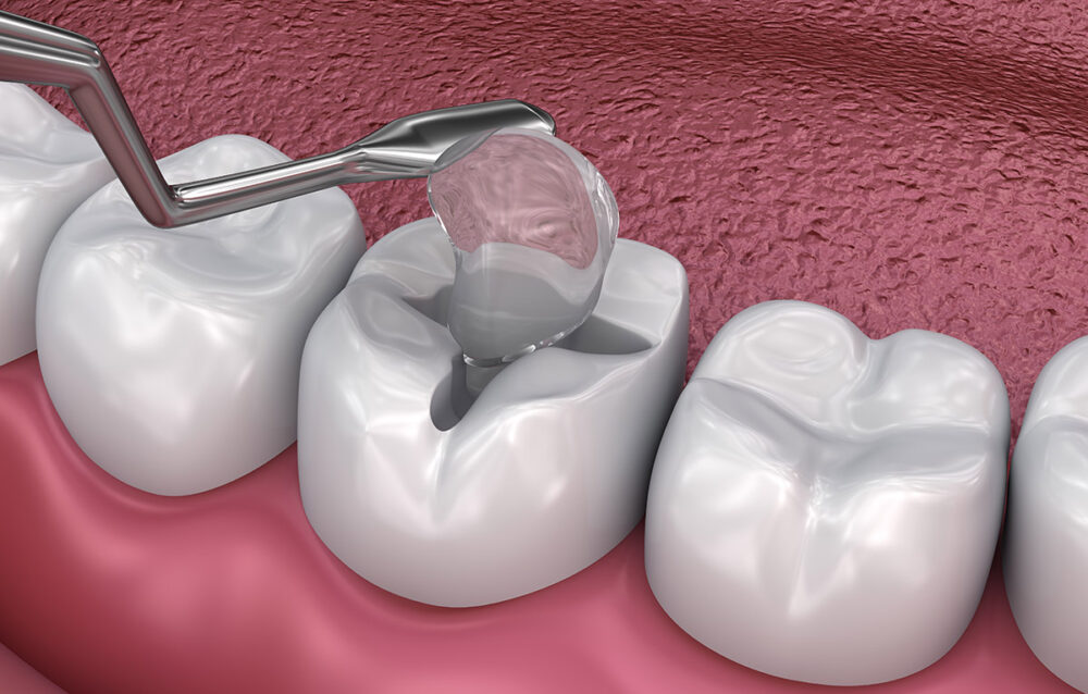 Understanding IRM in Dentistry: What Patients and Dentists Should Know