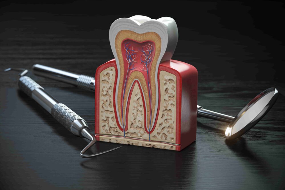 What Is Root Canal Treatment? Understanding the Procedure, Myths, Pros & Alternatives