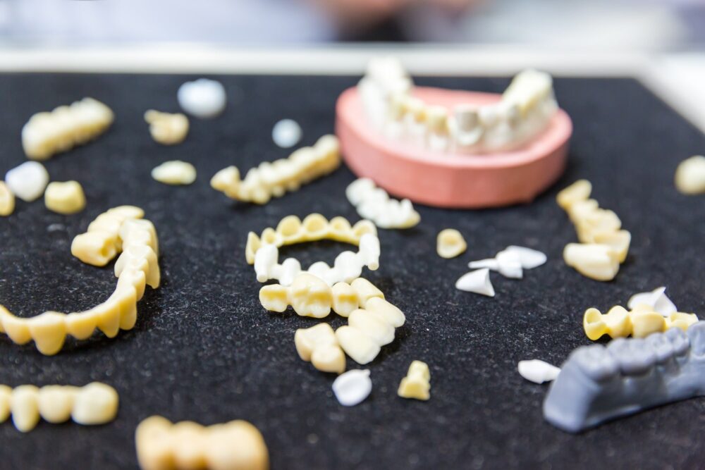 Precision Dental Bridges: Rigid vs. Non-Rigid – What’s the Difference and Why It Matters