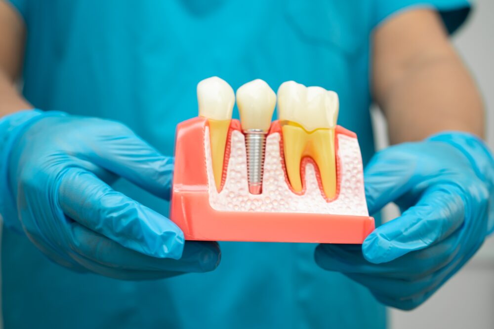 Looking for Dentures or Dental Implants in McKinney, TX?