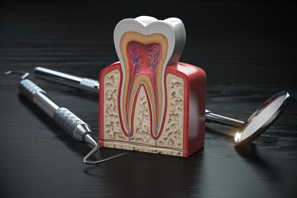 Root Canal Treatment in McKinney, TX: What You Need to Know